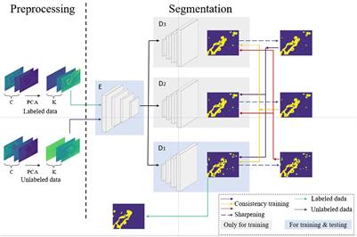 A semi-supervised segmentation method for microscopic hyperspectral pathological images based on multi-consistency learning